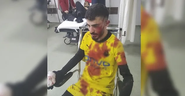 Ağrı Vefa Spor Maçında Taşlı Saldırı