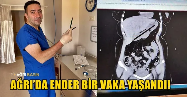 Ağrı’da genç kadının midesinden iki kalem çıkarıldı