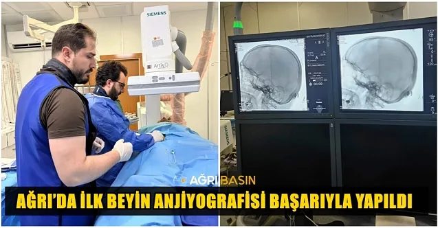 Ağrı’da İlk Beyin Anjiyografisi Başarıyla Yapıldı