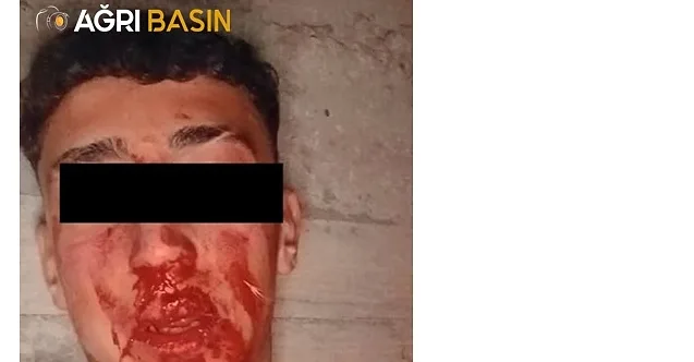Ağrı’da 16 Yaşındaki Gence Dehşet: Soruşturma Başlatıldı