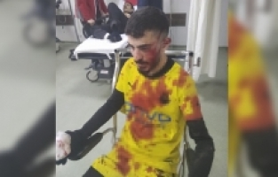 Ağrı Vefa Spor Maçında Taşlı Saldırı