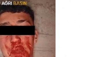 Ağrı’da 16 Yaşındaki Gence Dehşet: Soruşturma Başlatıldı