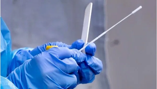 COVID-19 PCR testlerinde hızlı varyant tespiti